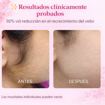 Aceite Cyperus Reductor Vello